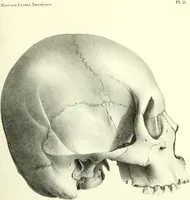 An illustration from Crania americana or, A comparative view of the skulls of various aboriginal nations of North and South America : to which is prefixed an essay on the varities of the human species / by Samuel George Morton. (1839)