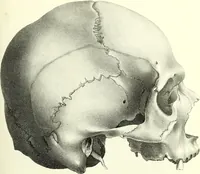 An illustration from Crania americana or, A comparative view of the skulls of various aboriginal nations of North and South America : to which is prefixed an essay on the varities of the human species / by Samuel George Morton. (1839)