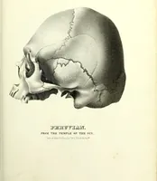 Picture 93 of 143 from Crania americana or, A comparative view of the skulls of various aboriginal nations of North and South America : to which is prefixed an essay on the varities of the human species / by Samuel George Morton. (1839), leaf 343