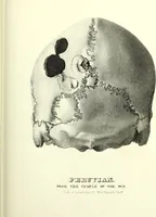 Picture 94 of 143 from Crania americana or, A comparative view of the skulls of various aboriginal nations of North and South America : to which is prefixed an essay on the varities of the human species / by Samuel George Morton. (1839), leaf 347