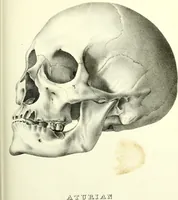 Picture 95 of 143 from Crania americana or, A comparative view of the skulls of various aboriginal nations of North and South America : to which is prefixed an essay on the varities of the human species / by Samuel George Morton. (1839), leaf 349