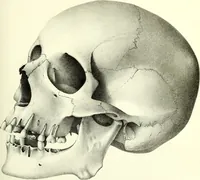 An illustration from Crania americana or, A comparative view of the skulls of various aboriginal nations of North and South America : to which is prefixed an essay on the varities of the human species / by Samuel George Morton. (1839)