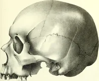 An illustration from Crania americana or, A comparative view of the skulls of various aboriginal nations of North and South America : to which is prefixed an essay on the varities of the human species / by Samuel George Morton. (1839)