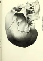 An illustration from Crania americana or, A comparative view of the skulls of various aboriginal nations of North and South America : to which is prefixed an essay on the varities of the human species / by Samuel George Morton. (1839)