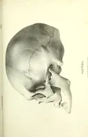 Picture 119 of 143 from Crania americana or, A comparative view of the skulls of various aboriginal nations of North and South America : to which is prefixed an essay on the varities of the human species / by Samuel George Morton. (1839), leaf 399