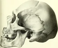 Picture 120 of 143 from Crania americana or, A comparative view of the skulls of various aboriginal nations of North and South America : to which is prefixed an essay on the varities of the human species / by Samuel George Morton. (1839), leaf 403
