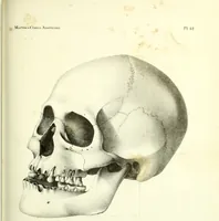 Picture 122 of 143 from Crania americana or, A comparative view of the skulls of various aboriginal nations of North and South America : to which is prefixed an essay on the varities of the human species / by Samuel George Morton. (1839), leaf 413