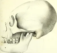 An illustration from Crania americana or, A comparative view of the skulls of various aboriginal nations of North and South America : to which is prefixed an essay on the varities of the human species / by Samuel George Morton. (1839)