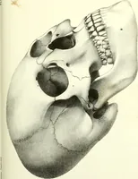 An illustration from Crania americana or, A comparative view of the skulls of various aboriginal nations of North and South America : to which is prefixed an essay on the varities of the human species / by Samuel George Morton. (1839)