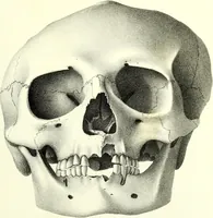 An illustration from Crania americana or, A comparative view of the skulls of various aboriginal nations of North and South America : to which is prefixed an essay on the varities of the human species / by Samuel George Morton. (1839)