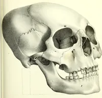 Picture 126 of 143 from Crania americana or, A comparative view of the skulls of various aboriginal nations of North and South America : to which is prefixed an essay on the varities of the human species / by Samuel George Morton. (1839), leaf 423