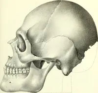 An illustration from Crania americana or, A comparative view of the skulls of various aboriginal nations of North and South America : to which is prefixed an essay on the varities of the human species / by Samuel George Morton. (1839)