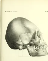 Picture 129 of 143 from Crania americana or, A comparative view of the skulls of various aboriginal nations of North and South America : to which is prefixed an essay on the varities of the human species / by Samuel George Morton. (1839), leaf 437
