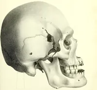 An illustration from Crania americana or, A comparative view of the skulls of various aboriginal nations of North and South America : to which is prefixed an essay on the varities of the human species / by Samuel George Morton. (1839)