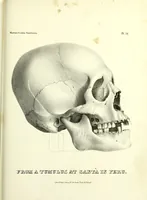 Picture 131 of 143 from Crania americana or, A comparative view of the skulls of various aboriginal nations of North and South America : to which is prefixed an essay on the varities of the human species / by Samuel George Morton. (1839), leaf 441