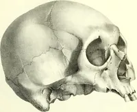 An illustration from Crania americana or, A comparative view of the skulls of various aboriginal nations of North and South America : to which is prefixed an essay on the varities of the human species / by Samuel George Morton. (1839)
