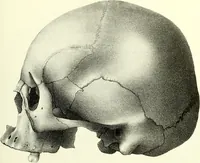 Picture 135 of 143 from Crania americana or, A comparative view of the skulls of various aboriginal nations of North and South America : to which is prefixed an essay on the varities of the human species / by Samuel George Morton. (1839), leaf 449