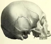 Picture 136 of 143 from Crania americana or, A comparative view of the skulls of various aboriginal nations of North and South America : to which is prefixed an essay on the varities of the human species / by Samuel George Morton. (1839), leaf 451