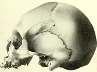 An illustration from Crania americana or, A comparative view of the skulls of various aboriginal nations of North and South America : to which is prefixed an essay on the varities of the human species / by Samuel George Morton. (1839)