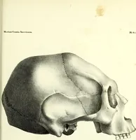 Picture 140 of 143 from Crania americana or, A comparative view of the skulls of various aboriginal nations of North and South America : to which is prefixed an essay on the varities of the human species / by Samuel George Morton. (1839), leaf 459