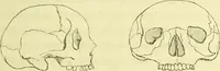 An illustration from Introduction a l'étude philosophique et pratique de la phrénologie. (1845)