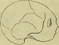 An illustration from Introduction a l'étude philosophique et pratique de la phrénologie. (1845)