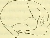 An illustration from Introduction a l'étude philosophique et pratique de la phrénologie. (1845)