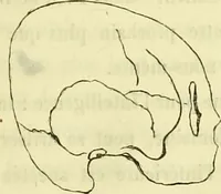 An illustration from Introduction a l'étude philosophique et pratique de la phrénologie. (1845)