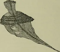 An illustration from A treatise on diseases of the skin with special reference to their diagnosis and treatment : including an analysis of 12,000 consecutive cases / Thomas McCall Anderson. (1894)