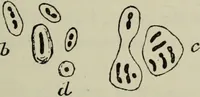 An illustration from A treatise on diseases of the skin with special reference to their diagnosis and treatment : including an analysis of 12,000 consecutive cases / Thomas McCall Anderson. (1894)