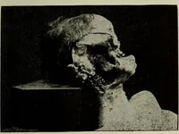 An illustration from A treatise on diseases of the skin with special reference to their diagnosis and treatment : including an analysis of 12,000 consecutive cases / Thomas McCall Anderson. (1894)