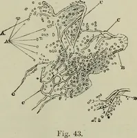 An illustration from A treatise on diseases of the skin with special reference to their diagnosis and treatment : including an analysis of 12,000 consecutive cases / Thomas McCall Anderson. (1894)