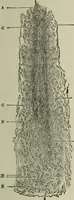 An illustration from A treatise on diseases of the skin with special reference to their diagnosis and treatment : including an analysis of 12,000 consecutive cases / Thomas McCall Anderson. (1894)