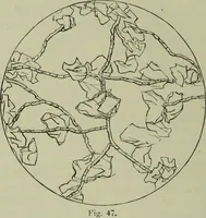 An illustration from A treatise on diseases of the skin with special reference to their diagnosis and treatment : including an analysis of 12,000 consecutive cases / Thomas McCall Anderson. (1894)