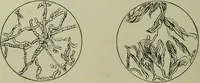 An illustration from A treatise on diseases of the skin with special reference to their diagnosis and treatment : including an analysis of 12,000 consecutive cases / Thomas McCall Anderson. (1894)