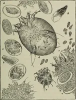 An illustration from A treatise on diseases of the skin with special reference to their diagnosis and treatment : including an analysis of 12,000 consecutive cases / Thomas McCall Anderson. (1894)
