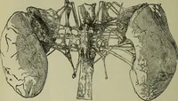 An illustration from A treatise on diseases of the skin with special reference to their diagnosis and treatment : including an analysis of 12,000 consecutive cases / Thomas McCall Anderson. (1894)
