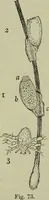 An illustration from A treatise on diseases of the skin with special reference to their diagnosis and treatment : including an analysis of 12,000 consecutive cases / Thomas McCall Anderson. (1894)