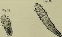 An illustration from A treatise on diseases of the skin with special reference to their diagnosis and treatment : including an analysis of 12,000 consecutive cases / Thomas McCall Anderson. (1894)