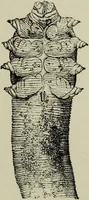 An illustration from A treatise on diseases of the skin with special reference to their diagnosis and treatment : including an analysis of 12,000 consecutive cases / Thomas McCall Anderson. (1894)