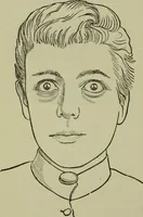 An illustration from A treatise on diseases of the skin with special reference to their diagnosis and treatment : including an analysis of 12,000 consecutive cases / Thomas McCall Anderson. (1894)