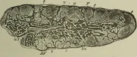 An illustration from A treatise on diseases of the skin with special reference to their diagnosis and treatment : including an analysis of 12,000 consecutive cases / Thomas McCall Anderson. (1894)