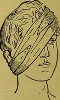An illustration from La nuova medicina natural : trattato d'insegnamento e di consultazione sul metodo di curare e di guarire le malattie seguendo le leggi di natura / di F.E. Bilz. (1895)