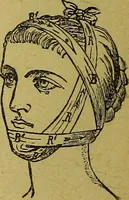 An illustration from La nuova medicina natural : trattato d'insegnamento e di consultazione sul metodo di curare e di guarire le malattie seguendo le leggi di natura / di F.E. Bilz. (1895)