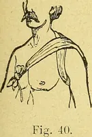 An illustration from La nuova medicina natural : trattato d'insegnamento e di consultazione sul metodo di curare e di guarire le malattie seguendo le leggi di natura / di F.E. Bilz. (1895)