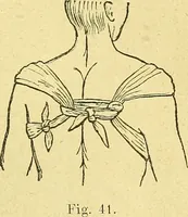 An illustration from La nuova medicina natural : trattato d'insegnamento e di consultazione sul metodo di curare e di guarire le malattie seguendo le leggi di natura / di F.E. Bilz. (1895)