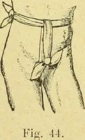 An illustration from La nuova medicina natural : trattato d'insegnamento e di consultazione sul metodo di curare e di guarire le malattie seguendo le leggi di natura / di F.E. Bilz. (1895)