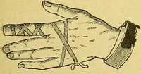 An illustration from La nuova medicina natural : trattato d'insegnamento e di consultazione sul metodo di curare e di guarire le malattie seguendo le leggi di natura / di F.E. Bilz. (1895)