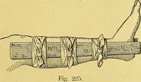An illustration from La nuova medicina natural : trattato d'insegnamento e di consultazione sul metodo di curare e di guarire le malattie seguendo le leggi di natura / di F.E. Bilz. (1895)