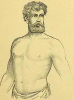An illustration from La nuova medicina natural : trattato d'insegnamento e di consultazione sul metodo di curare e di guarire le malattie seguendo le leggi di natura / di F.E. Bilz. (1895)